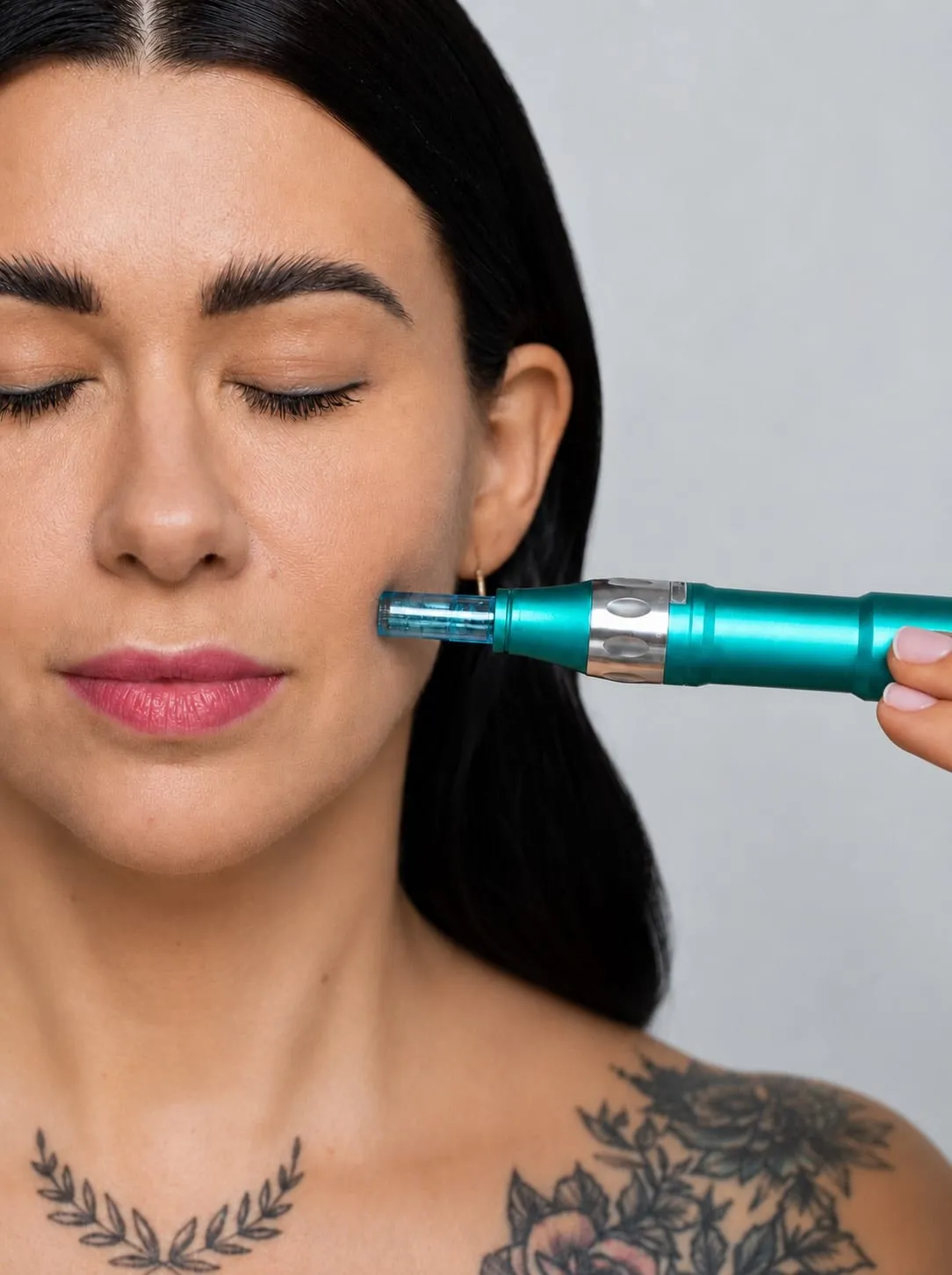 Microneedling treatment at SK But First Beauty, Long Island